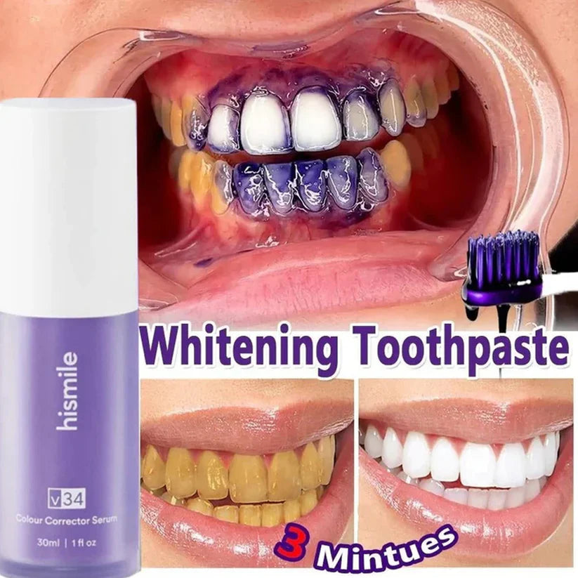 Instant Teeth Whitening Hi-Smiles Paste (30 ml) From Yellow To White